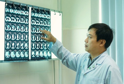 Lấy khối u lớn trong lồng ngực bệnh nhân 66 tuổi