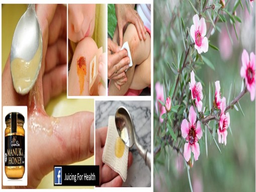 Tiềm năng chống siêu khuẩn kháng thuốc từ mật ong Manuka