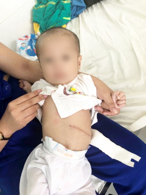 Triển khai một số phẫu thuật sơ sinh - nhũ nhi