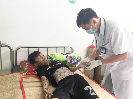 Cảnh báo bệnh thủy đậu