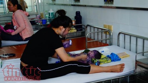 Gia tăng trẻ nhỏ nhập viện vì bệnh thủy đậu