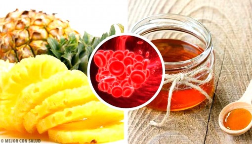 Những phương pháp đơn giản phòng chống huyết khối