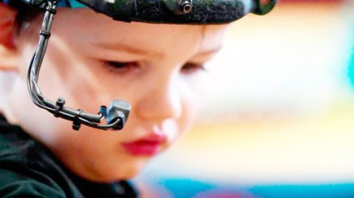 Đo kích thước đồng tử có thể giúp chẩn đoán sớm bệnh tự kỷ