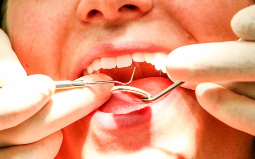 Bồi thường vì không phát hiện răng sâu