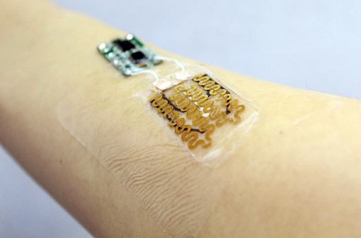 Băng y tế điện tử tăng hiệu quả chữa lành vết thương