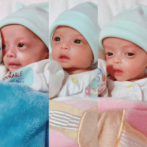 3 bé sinh non tháng thụ tinh trong ống nghiệm đã khỏe mạnh xuất viện