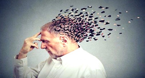 Phát hiện mối liên hệ giữa bệnh tim và Alzheimer