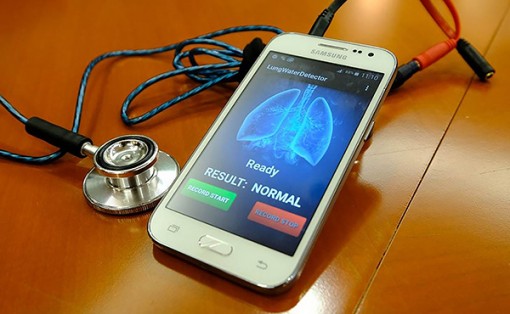 Hệ thống nghe phổi giúp nhận diện nguy cơ

suy tim xung huyết