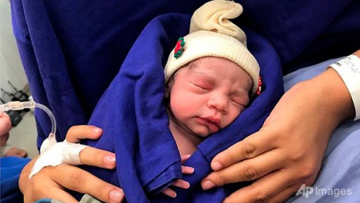 Em bé đầu tiên ra đời từ tử cung

của người chết