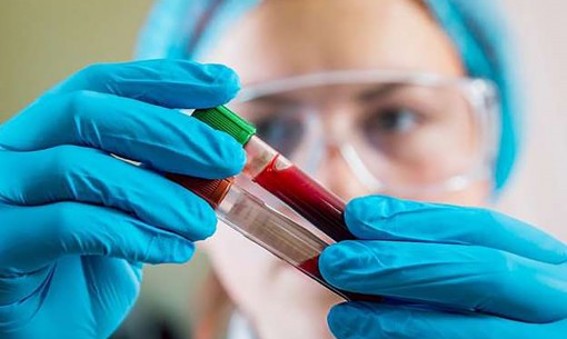 Xét nghiệm máu chẩn đoán sớm

ung thư phổi