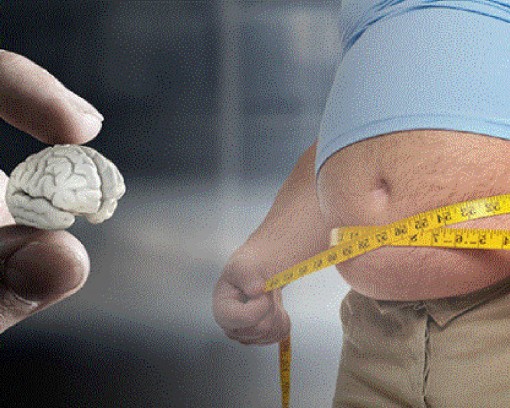 Béo phì dẫn đến teo não
