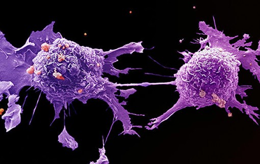 Phát hiện “gót chân Achilles” của tế bào ung thư