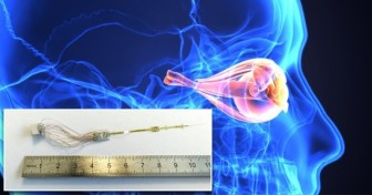 OpticSELINE hứa hẹn giúp người mù nhìn thấy ánh sáng