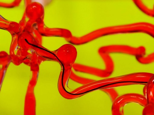 Chỉ robot luồn lách trong não chữa đột quỵ