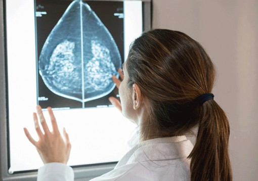 Ứng dụng AI tạo bước ngoặt trong chẩn đoán ung thư vú