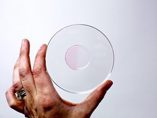 Cảm biến nano giúp 
hạn chế tổn thương 
cho bệnh nhân xạ trị