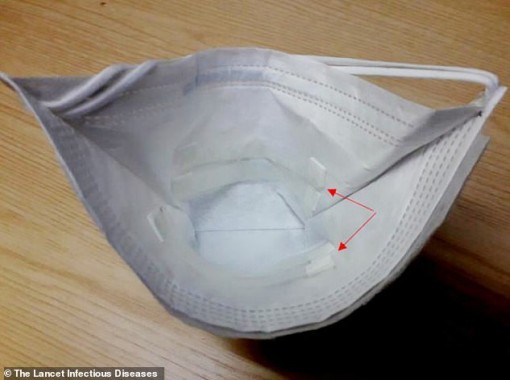 Khẩu trang chẩn đoán nhanh bệnh lao