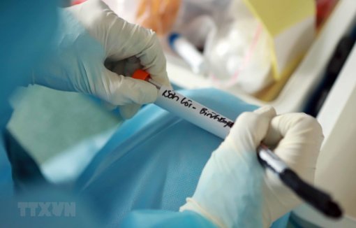 Khoảng 30 địa chỉ ở Việt Nam có thể xét nghiệm COVID-19