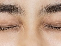 Lông mày thưa dần có thể là dấu hiệu bệnh tật