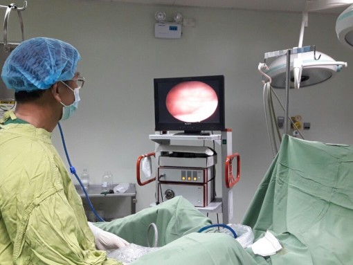 Nội soi gắp 3 đoạn ống thông JJ đặt trong niệu quản 3 năm