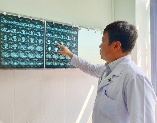 Nhận diện bướu giáp thòng gây tai biến mạch máu não