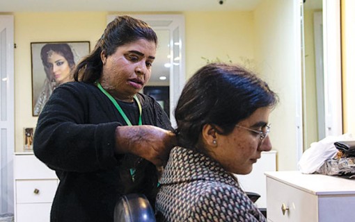 Nạn nhân axít làm đẹp cho đời