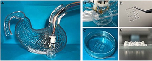 Sử dụng công nghệ in 3D sinh học điều trị tổn thương thành dạ dày