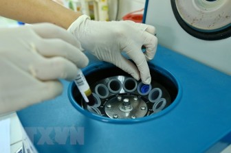Báo động tình trạng người Việt Nam thừa cholesterol ở mức cao