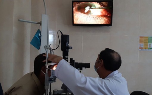 Suýt mù mắt do keo dán sắt văng vào