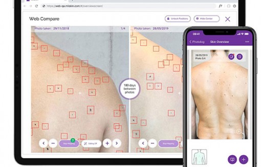 Phát hiện khả năng bảo vệ tế bào da khỏi tia UV của vitamin B3