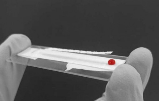 “Cứu tinh” cho những ca bệnh mất máu nặng