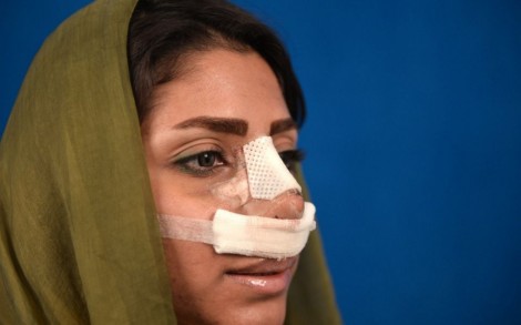 Iran cấm bác sĩ nam phẫu thuật thẩm mỹ cho nữ