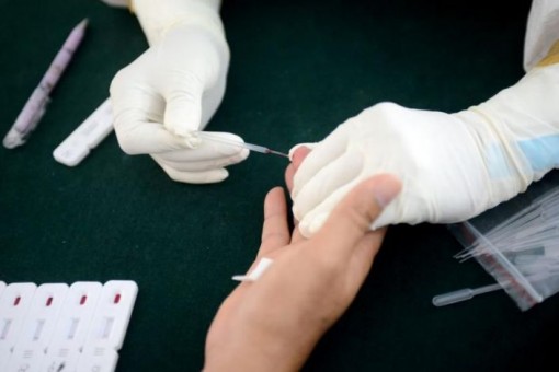 Xét nghiệm dự báo mức độ nghiêm trọng khi nhiễm COVID-19