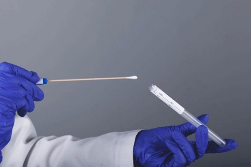 Chẩn đoán bệnh Parkinson bằng xét nghiệm qua da