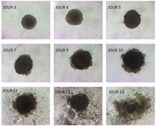 Axít béo omega-3 trong cá - “kẻ thù” của tế bào ung thư