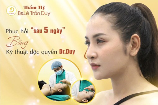 Nâng mũi cấu trúc