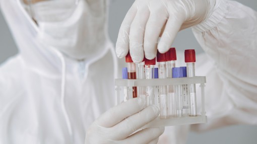 Xét nghiệm máu phát hiện sớm nguy cơ sa sút trí tuệ