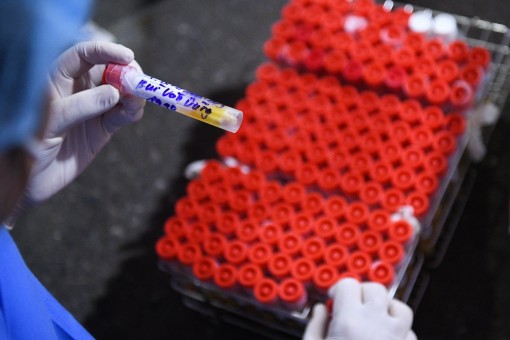 Bộ Y tế quy định mới về giá dịch vụ xét nghiệm SARS-CoV-2