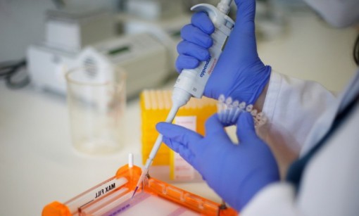 Triển vọng mới trong phòng, chống bệnh liên quan lão hóa