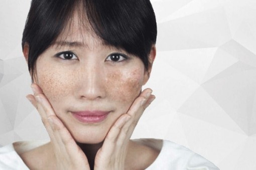 Khám phá công nghệ điều trị nám Pico Cell tại JK Việt Nam