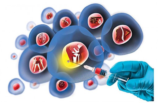 5 phương pháp điều trị tiềm năng dựa trên tế bào gốc