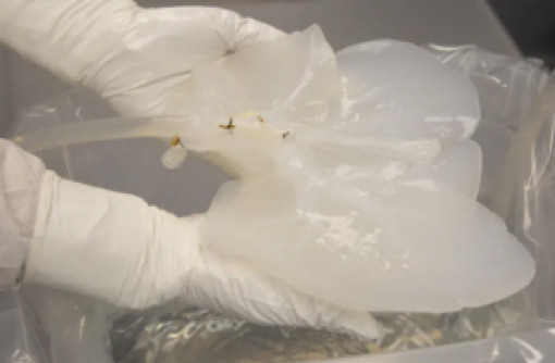 Thử nghiệm biến đổi gan heo để cấy ghép cho người