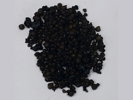 Gắp hơn 400 viên sỏi trong túi mật nữ bệnh nhân 44 tuổi