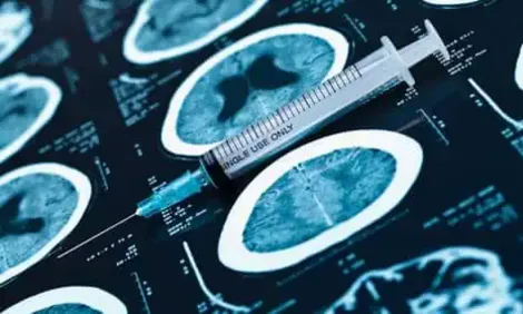 Vaccine hơn trăm tuổi có thể là “vũ khí” mới phòng chống Alzheimer?