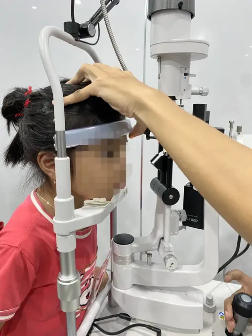 Bác sĩ xử lý rận mi chi chít trên mắt bệnh nhi