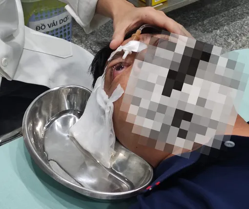 Cấp cứu kịp thời đôi mắt bị bỏng axit do tai nạn lao động