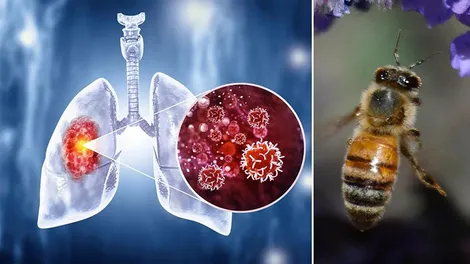 Ong mật có thể “đánh hơi” bệnh ung thư phổi