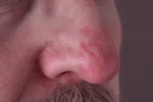 Mũi tiết lộ điều gì về sức khỏe?