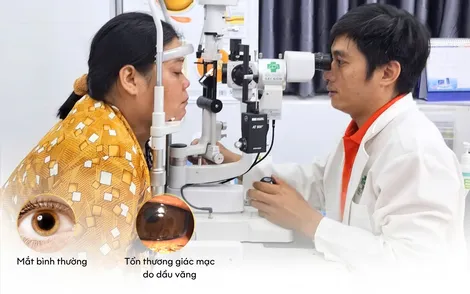 Chiên cá bị dầu văng, bỏng mắt