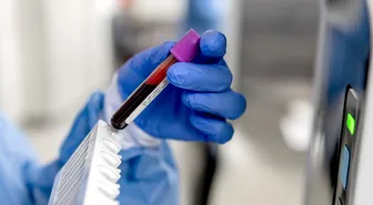 Xét nghiệm máu giúp hé lộ tốc độ lão hóa nội tạng